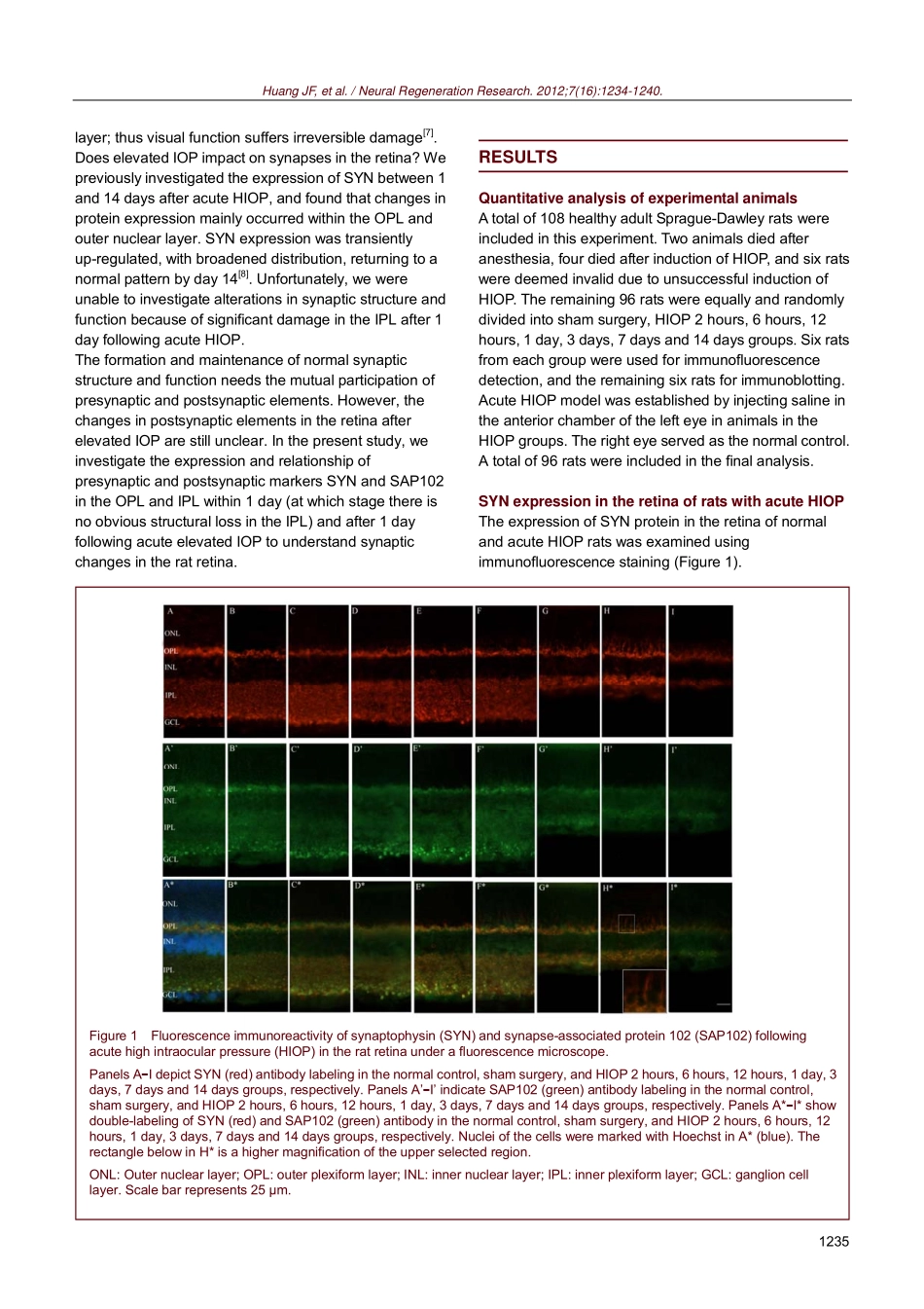 高眼压损伤视网膜突触前成分的时空变化_第2页