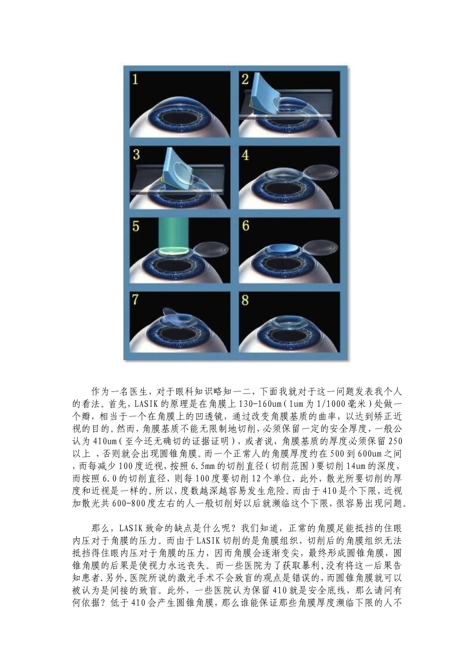 近视激光手术的利弊_第2页