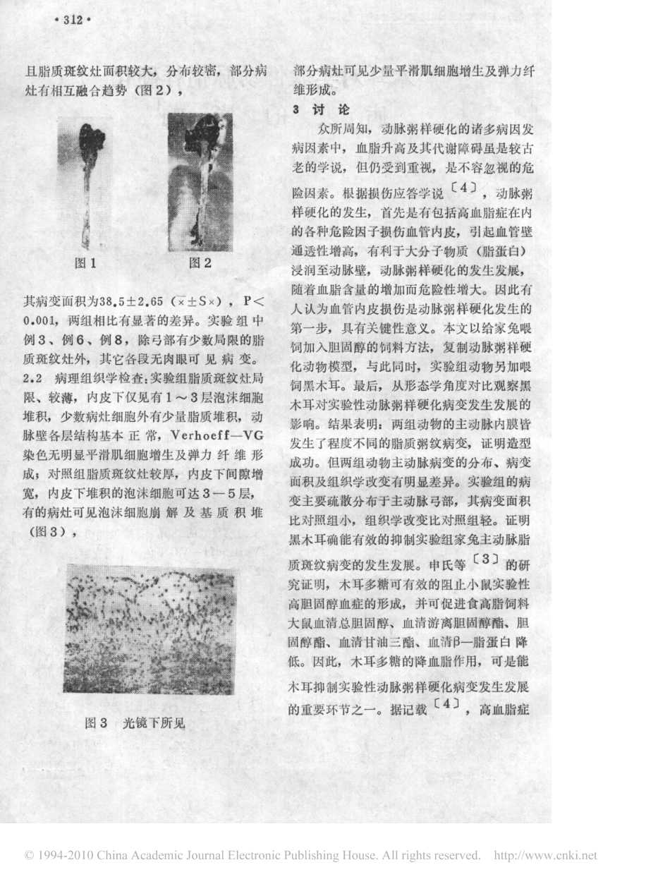 黑木耳对实验性动脉粥样硬化病变的影响_第2页
