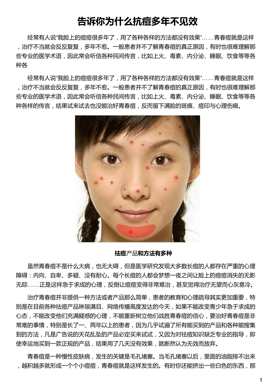 告诉你为什么抗痘多年不见效_第1页