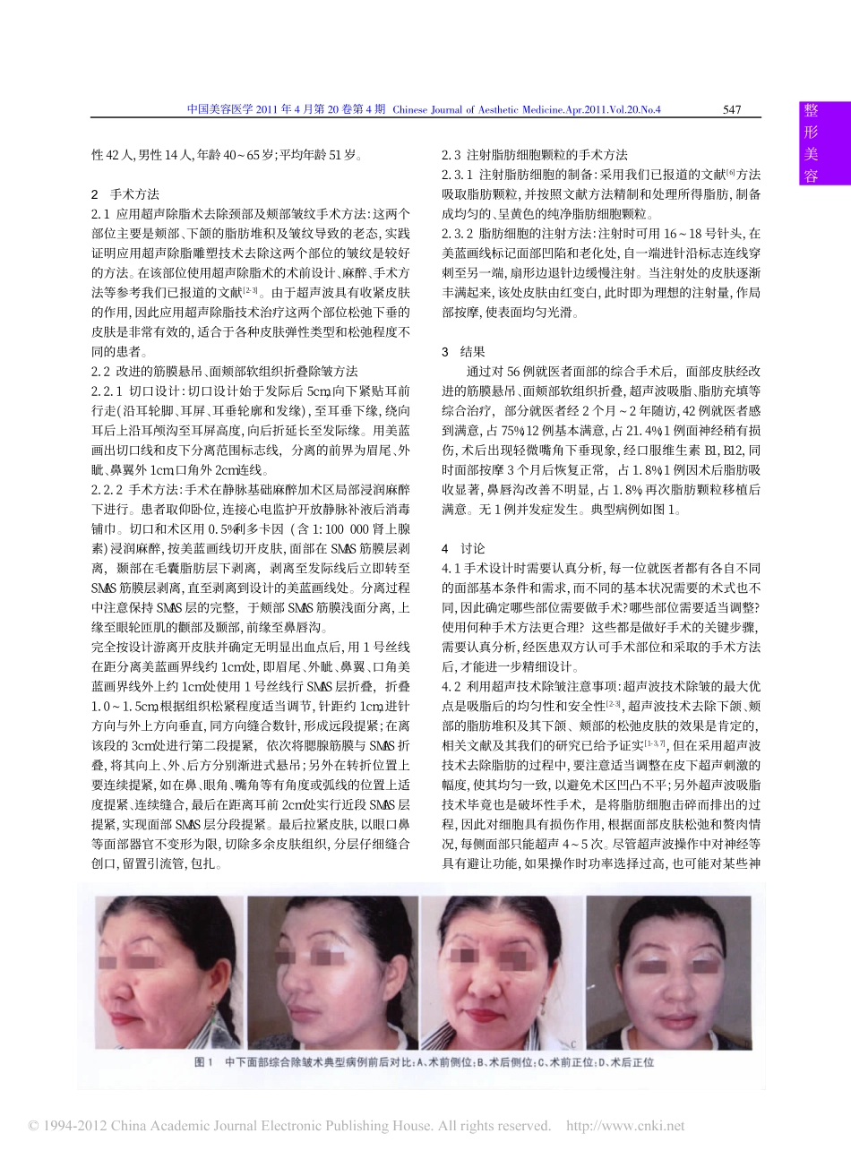 改良的中下面部三维综合除皱术在面部年轻化中的应用_王晓媛_第2页