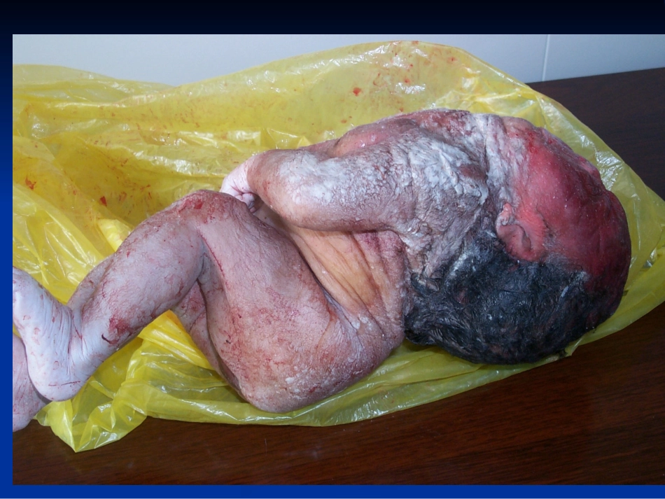 畸形婴儿图片_第3页