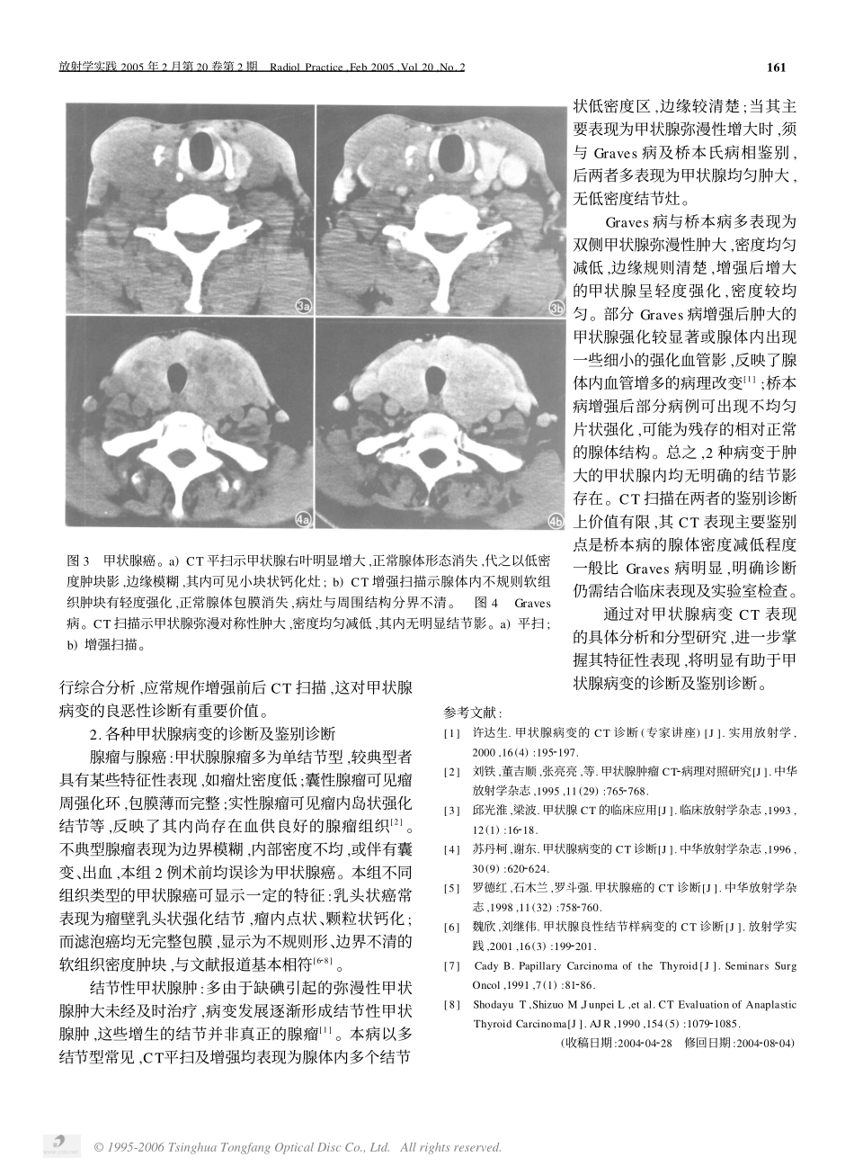 甲状腺病变的CT诊断及鉴别诊断_第3页