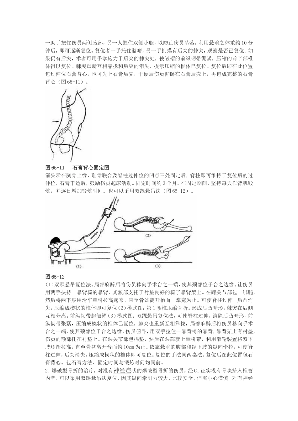 脊椎骨折应该怎么做_第3页