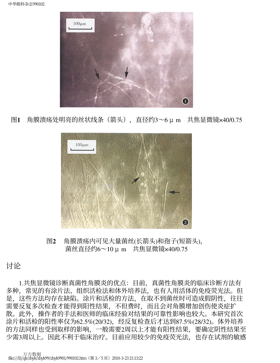 共焦显微镜在真菌性角膜炎临床诊断中的应用_第3页
