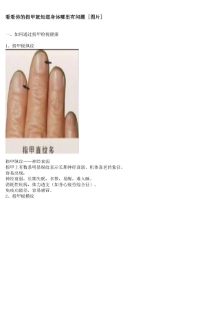 看看你的指甲就知道身体哪里有问题 [图片]