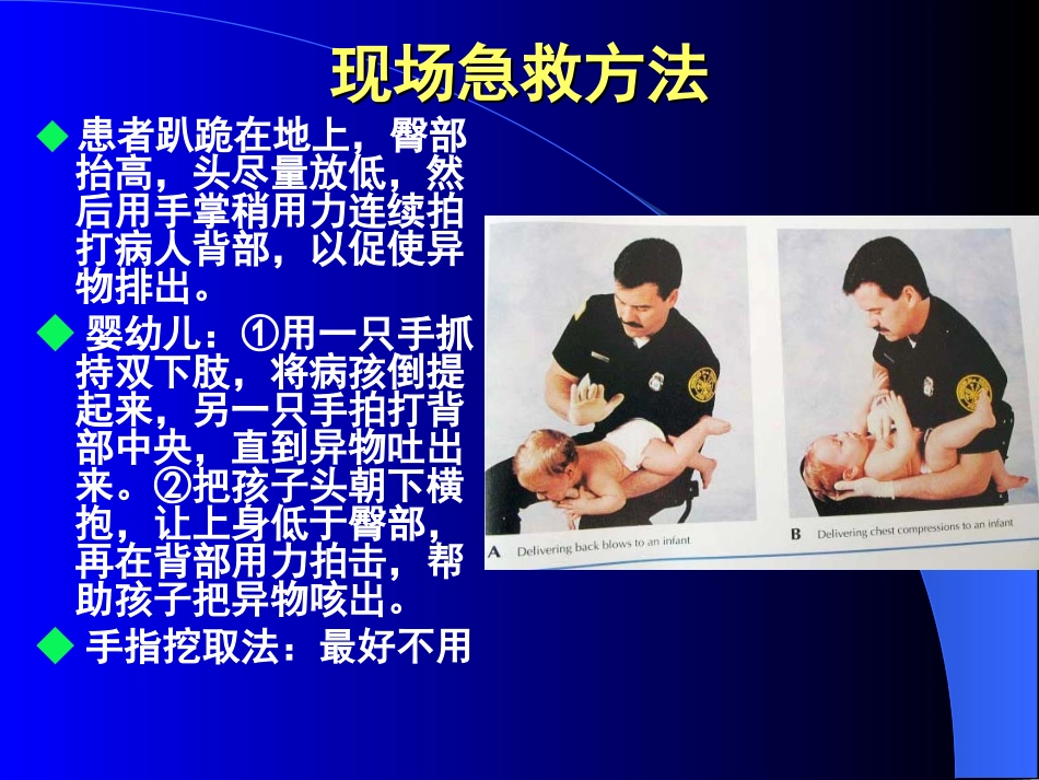 呼吸道异物处理_第3页