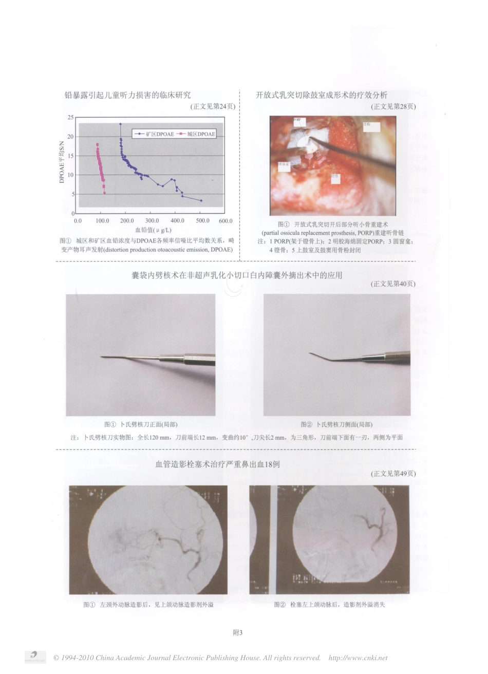 开放式乳突切除鼓室成形术的疗效分析_第3页
