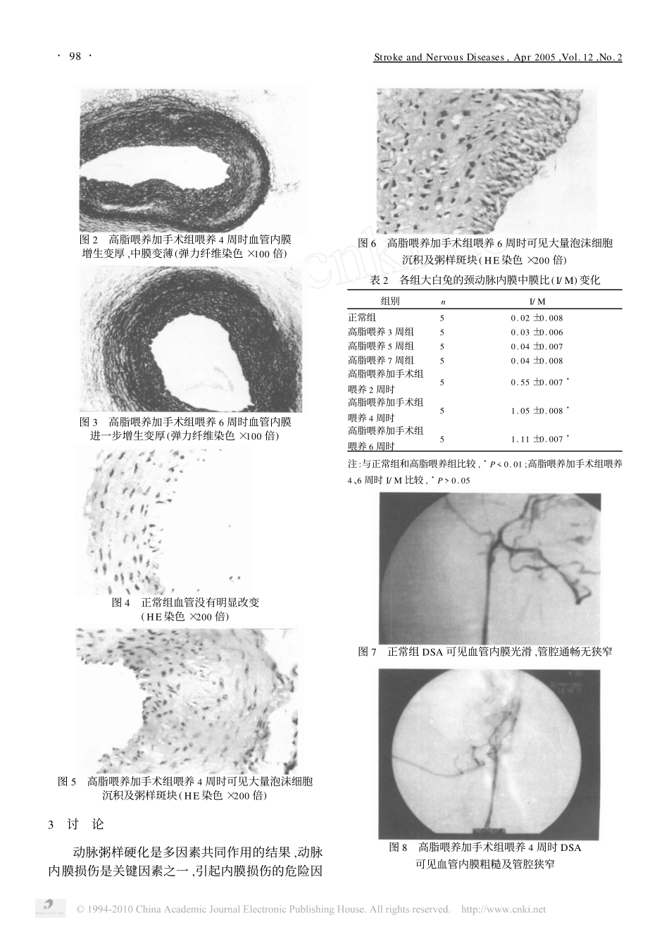 家兔颈动脉粥样硬化模型的建立_第3页