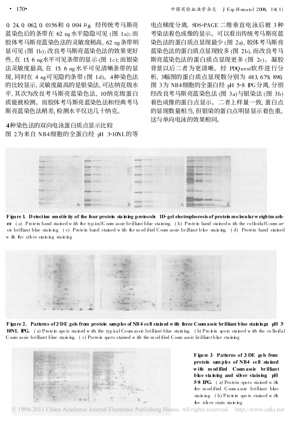 几种双向凝胶电泳蛋白质检测方法的比较_第3页