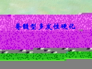 脊髓型多发性硬化