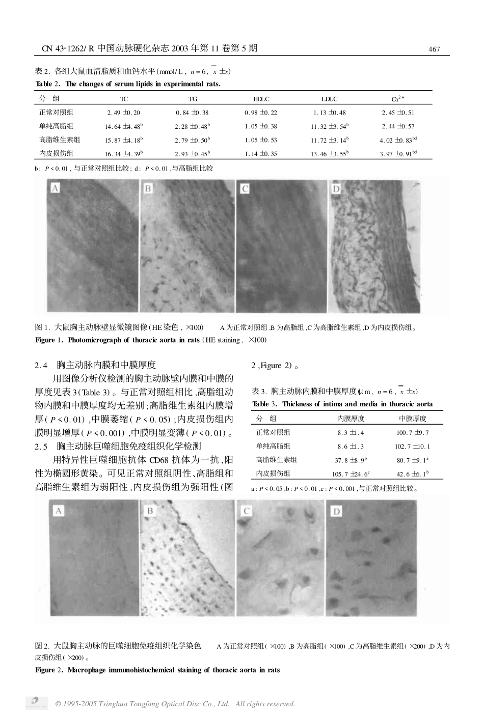 建立合适的动脉粥样硬化_第3页