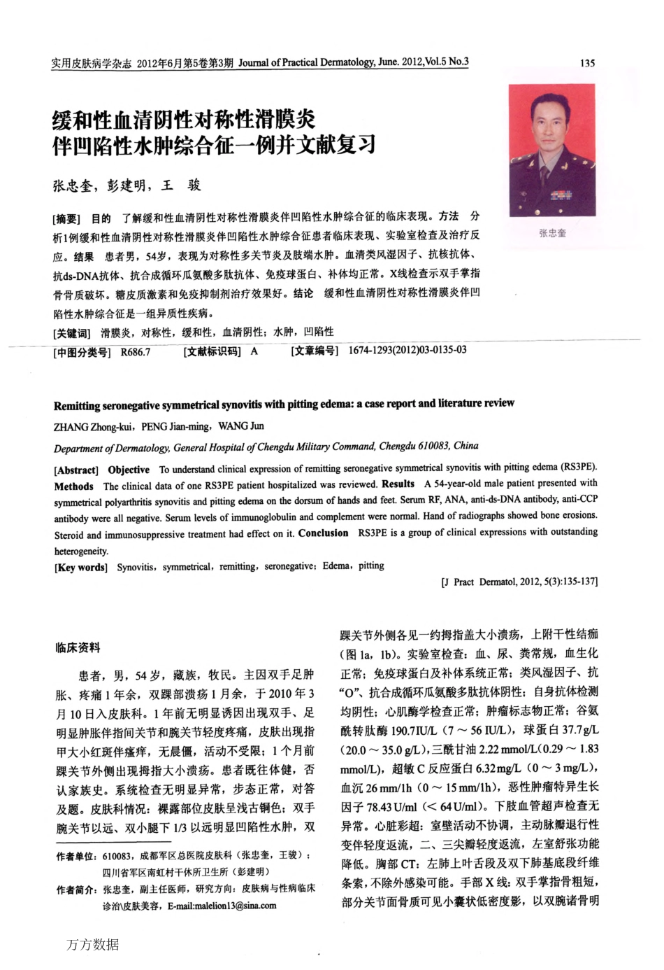 缓和性血清阴性对称性滑膜炎伴凹陷性水肿综合征一例并文献复习_第1页