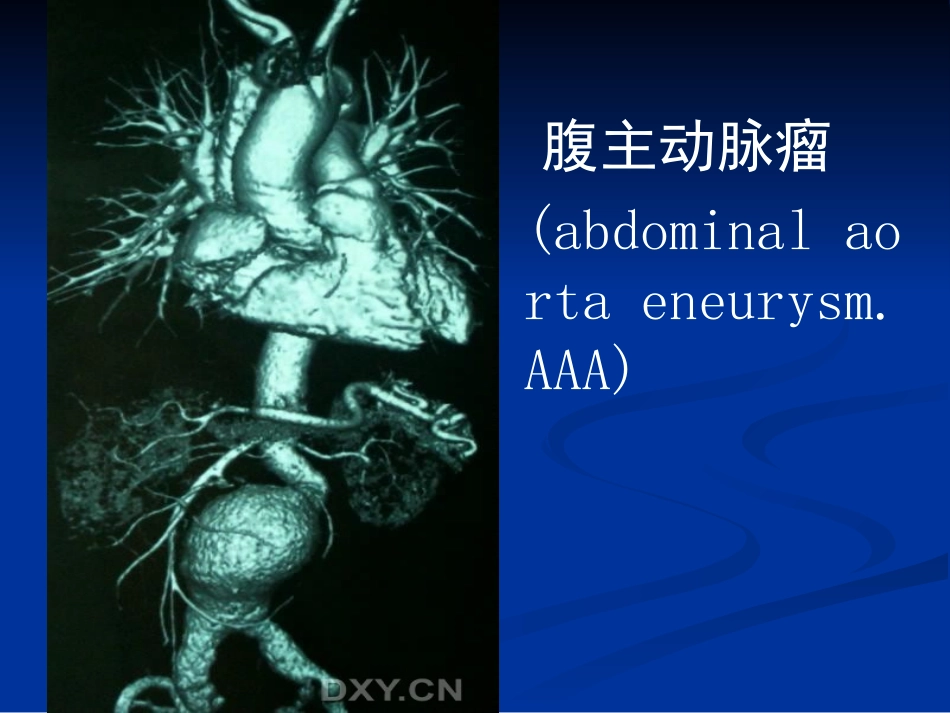 腹主动脉瘤人工血管置换术的麻醉_第2页