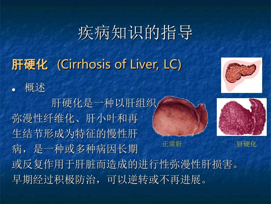 肝硬化的健康教育_第2页