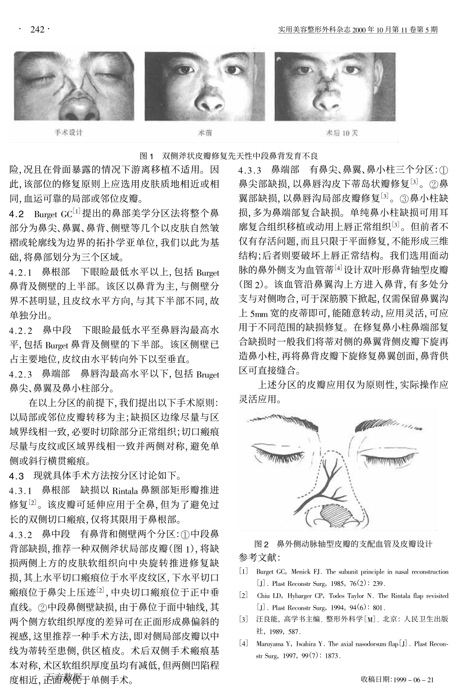 局部或邻位皮瓣修复鼻部软组织缺损的分区应用_第2页