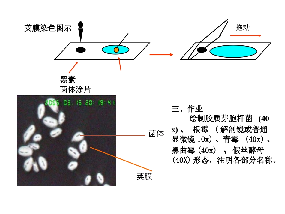荚膜、真菌观察_第3页