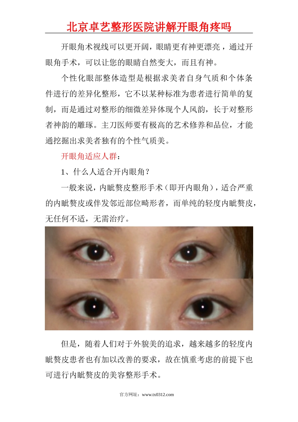 开眼角疼吗？_第2页