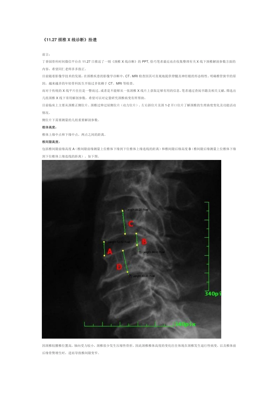 颈椎 X 线诊断_第1页