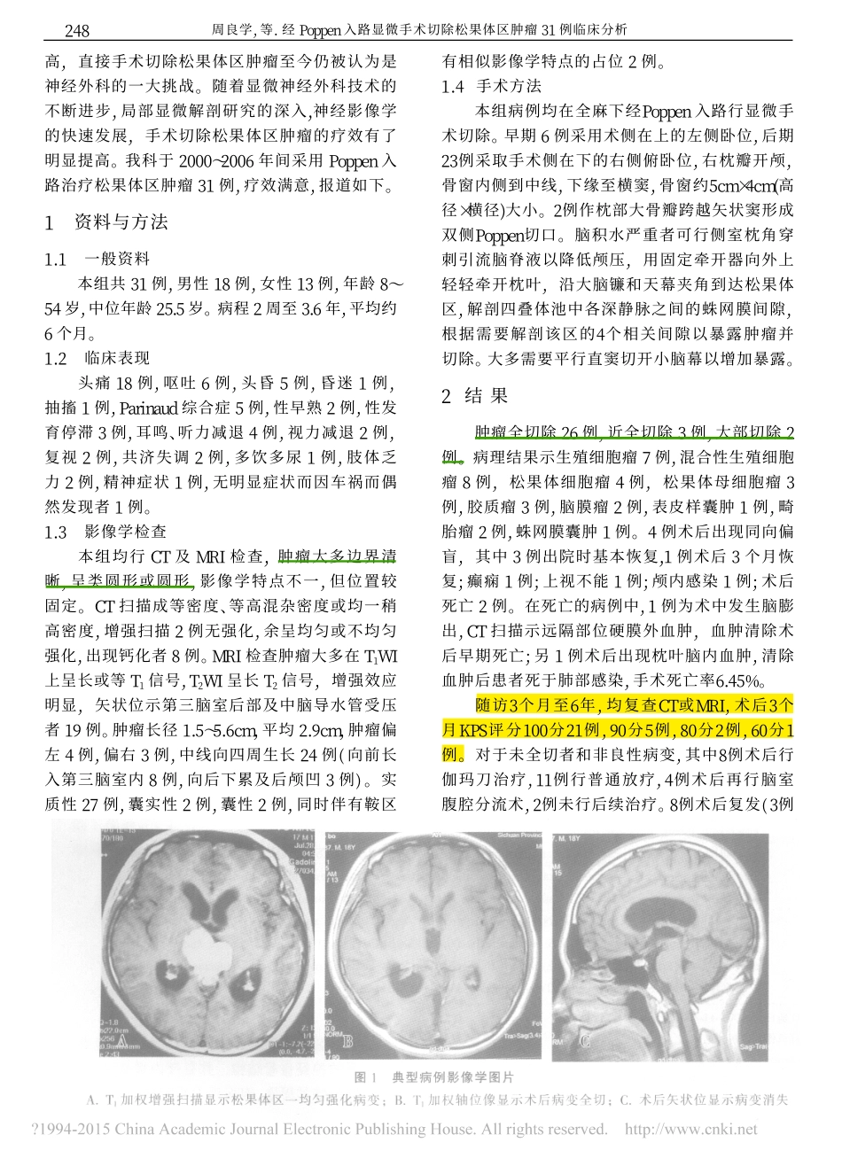 经Poppen入路显微手术切除松果体区肿瘤31例临床分析_周良学_第2页