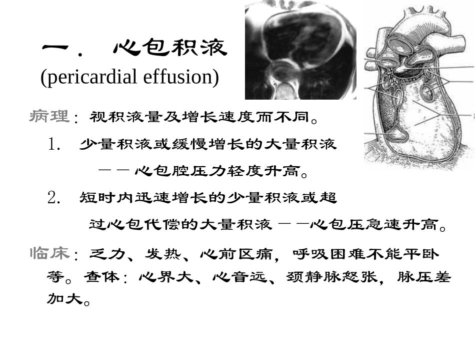 后得性心脏病的影像学诊断_第3页