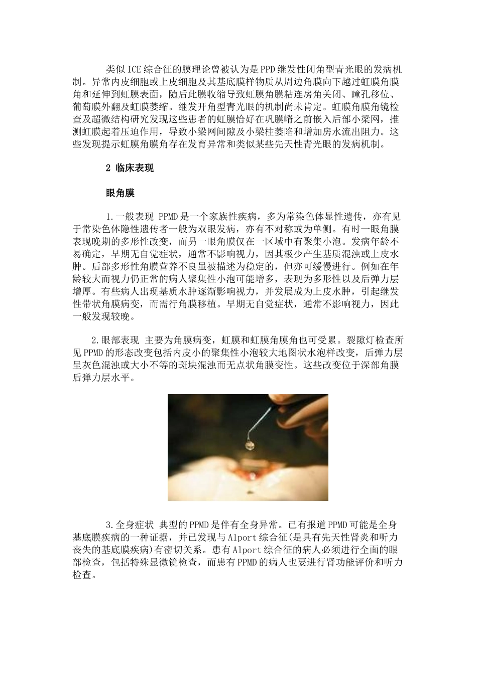 后部多形性角膜营养不良_第2页