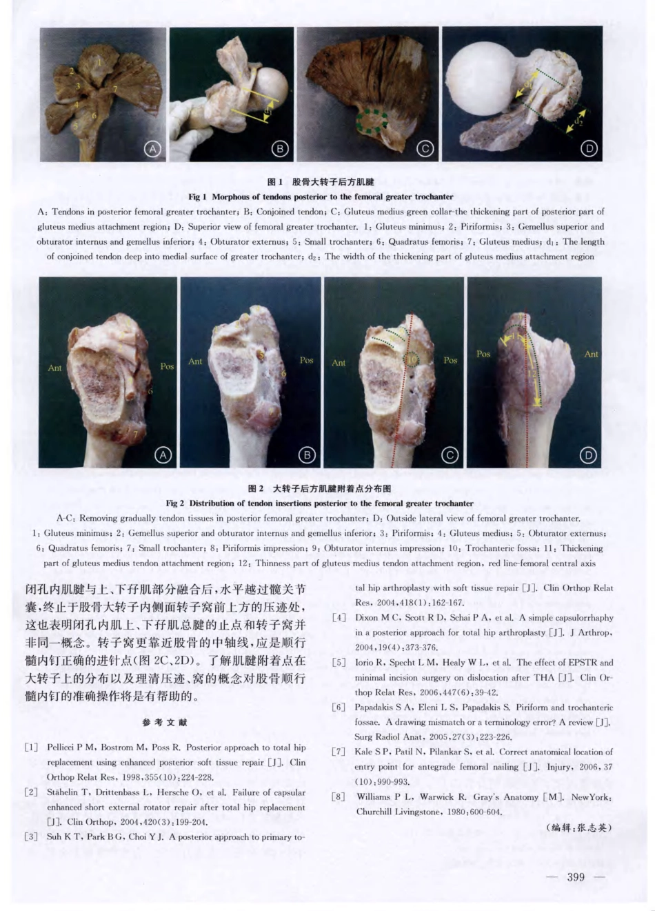 股骨大转子后方肌腱止点的解剖学观测及临床意义_第3页