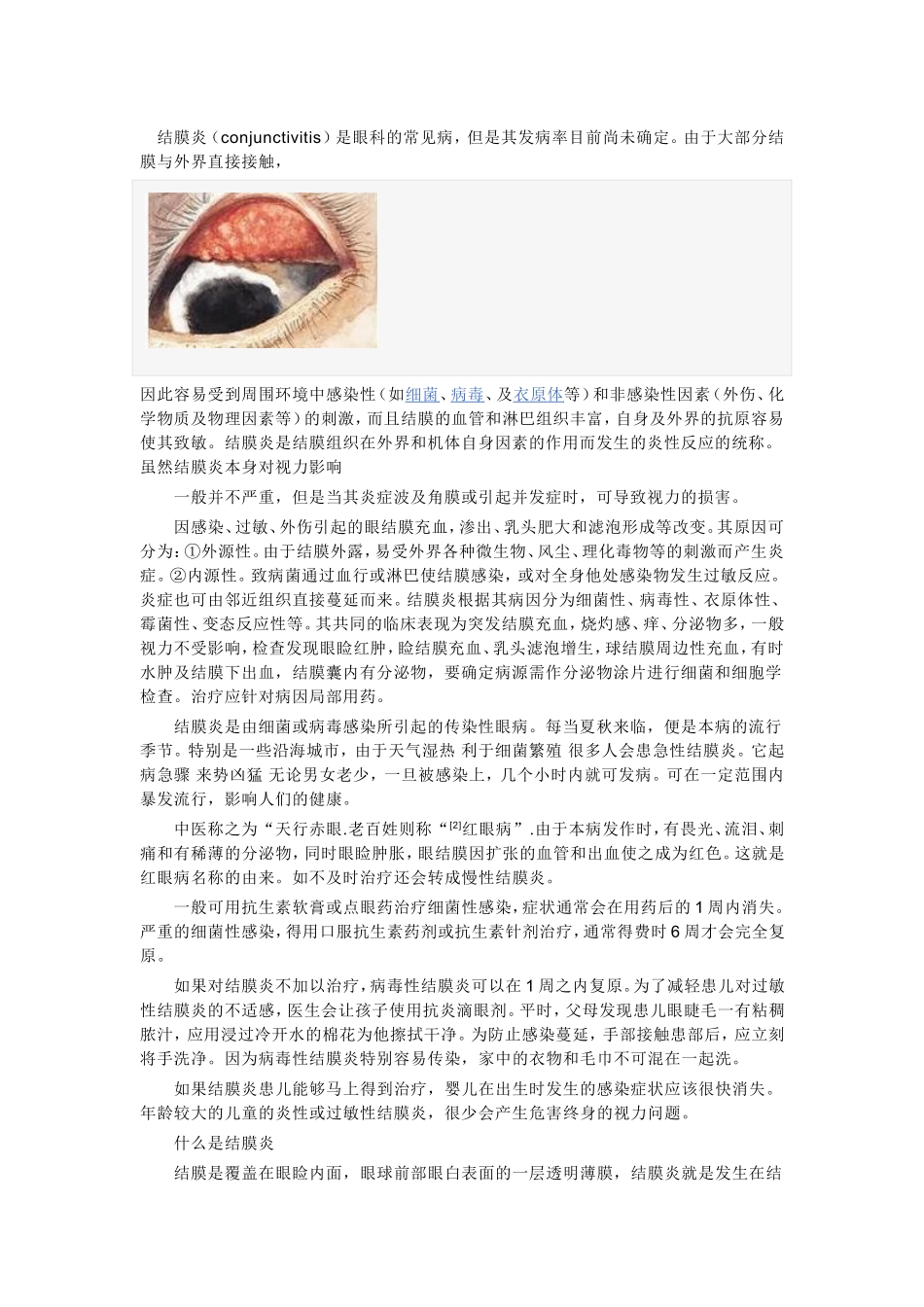 结膜炎(conjunctivitis)是眼科的常见病,但是其发病率目前尚未确定_第1页