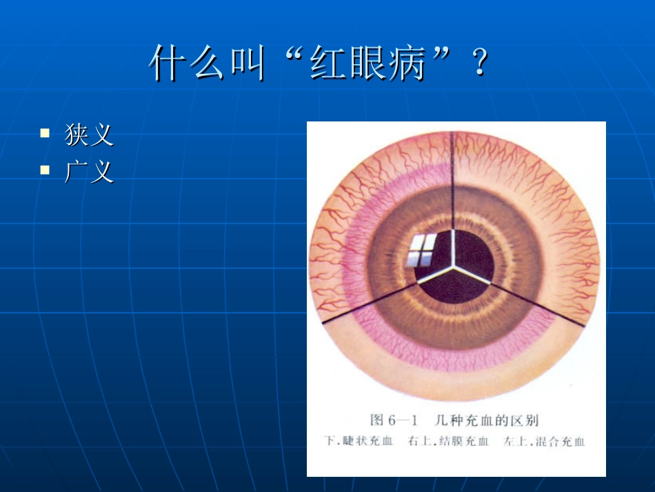 红眼病的鉴别诊断-lsn_第2页