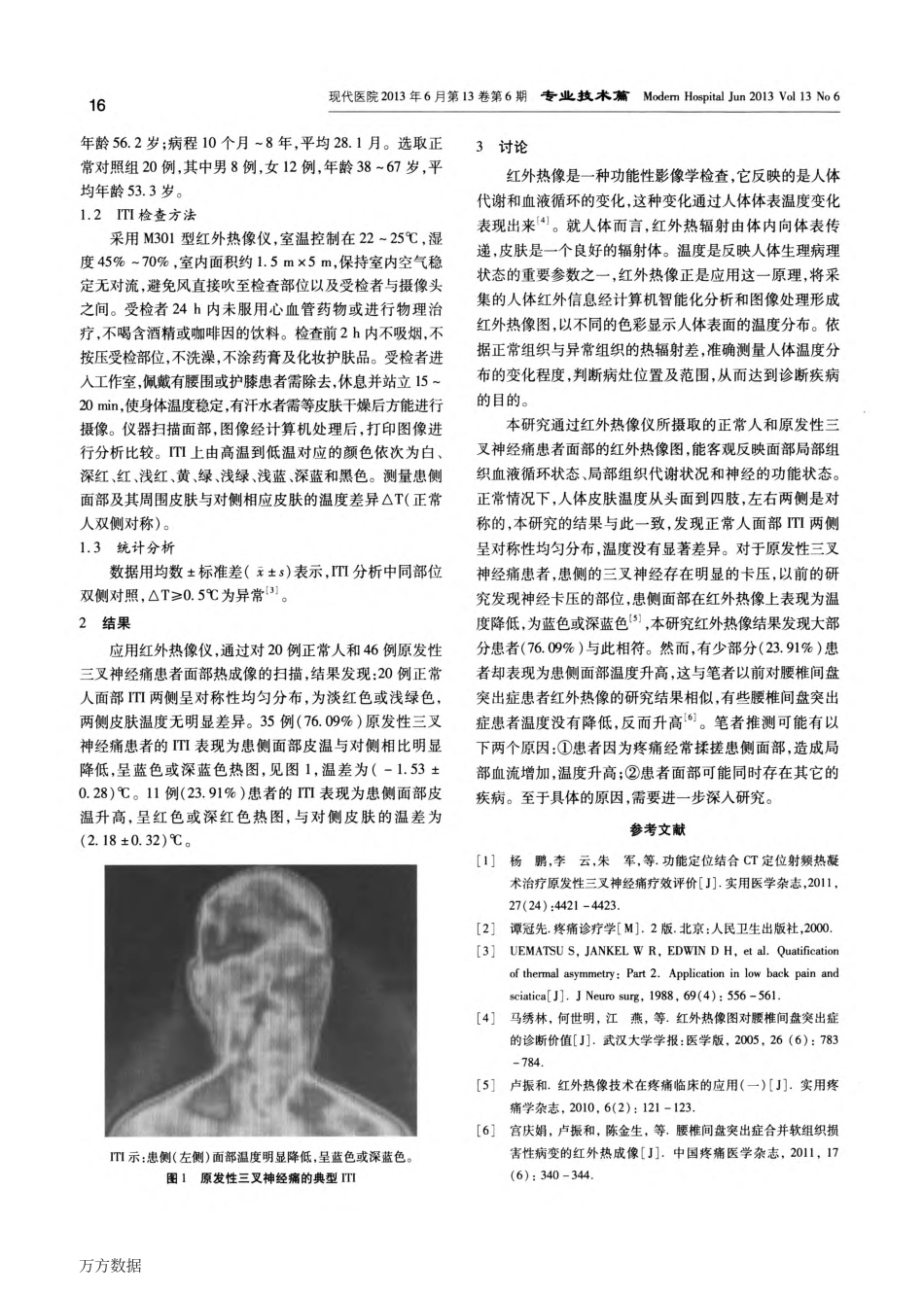红外热像在原发性三叉神经痛诊断中的价值_第2页