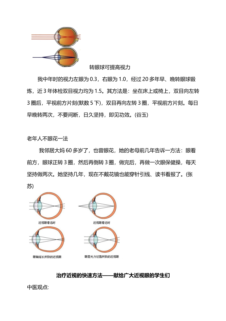 近视可以不戴眼镜的方法_第2页