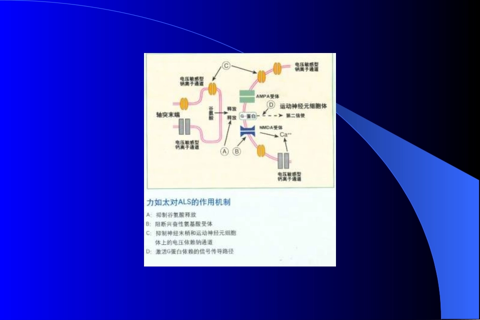 肌萎缩侧索硬化症_第2页
