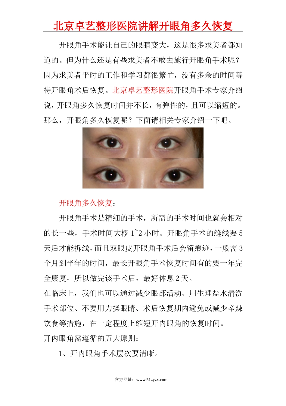 开眼角多久恢复？_第1页