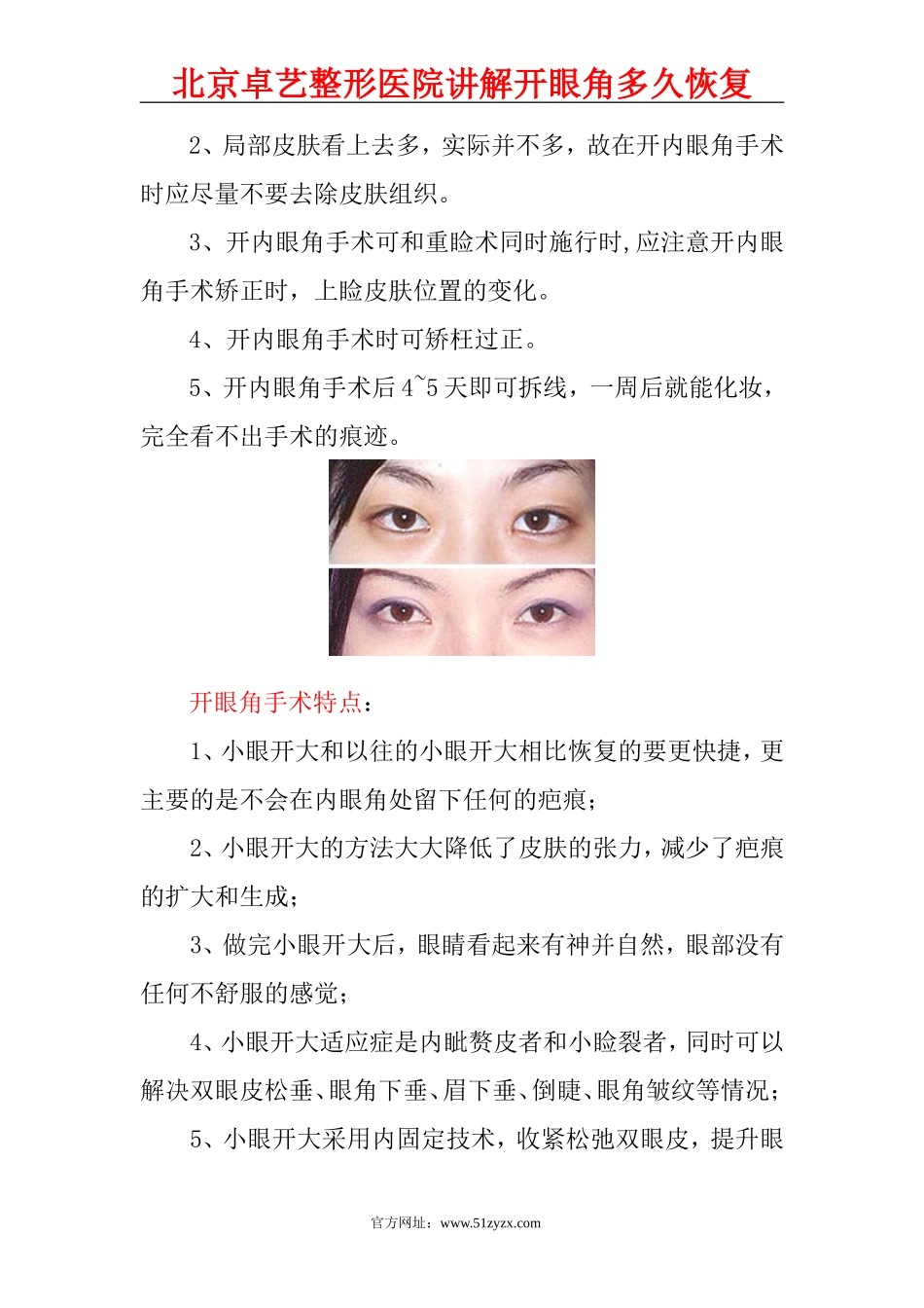 开眼角多久恢复？_第2页