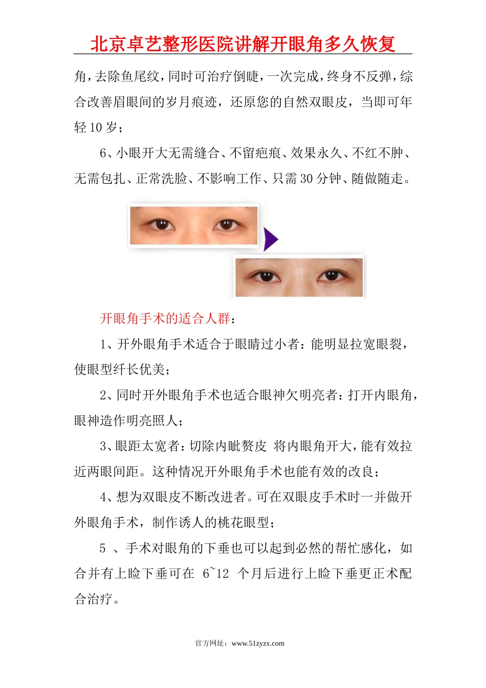 开眼角多久恢复？_第3页
