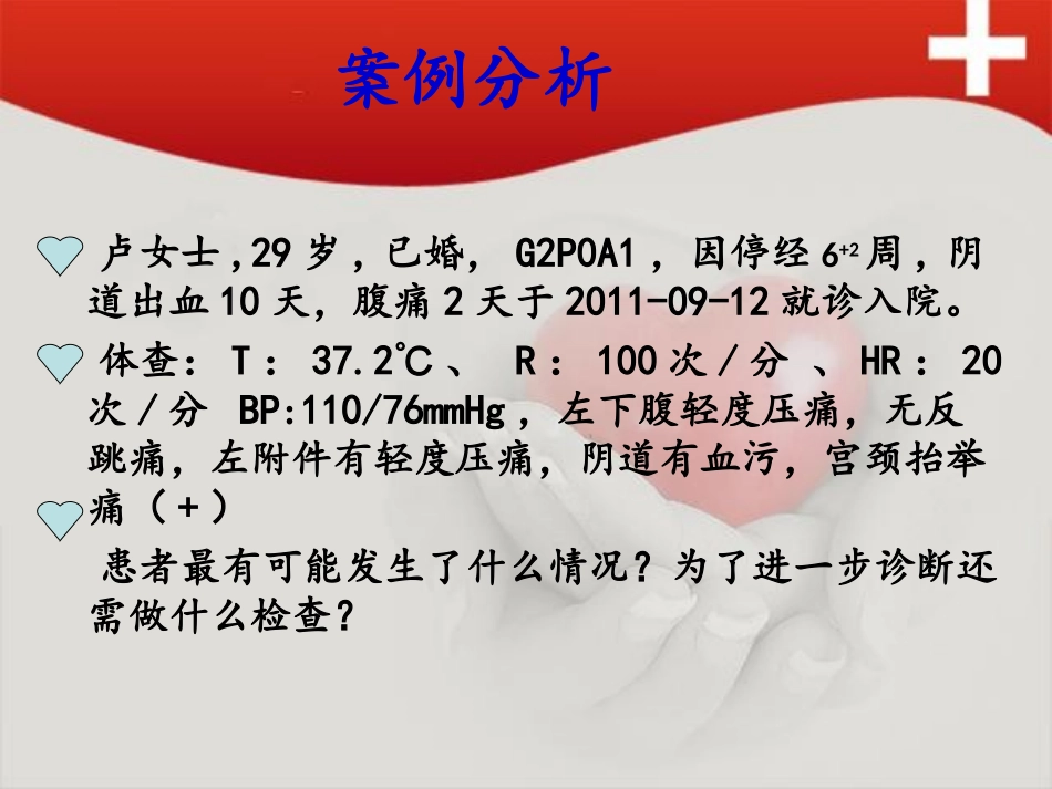 妇一概念图4_第2页