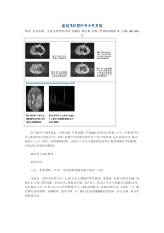 鉴别几种假性卒中常见病