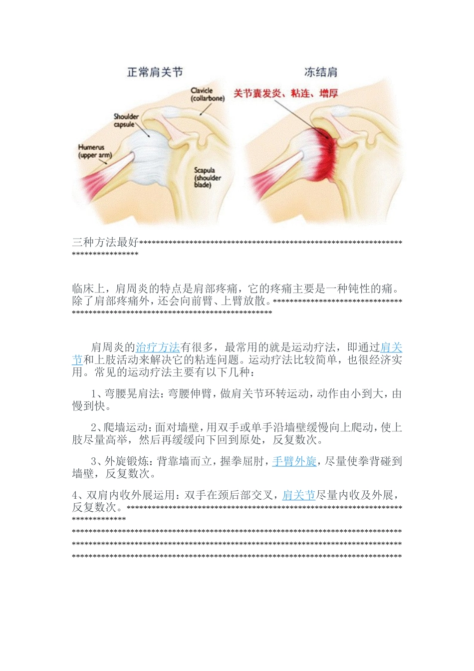 肩周炎治疗60法_第3页