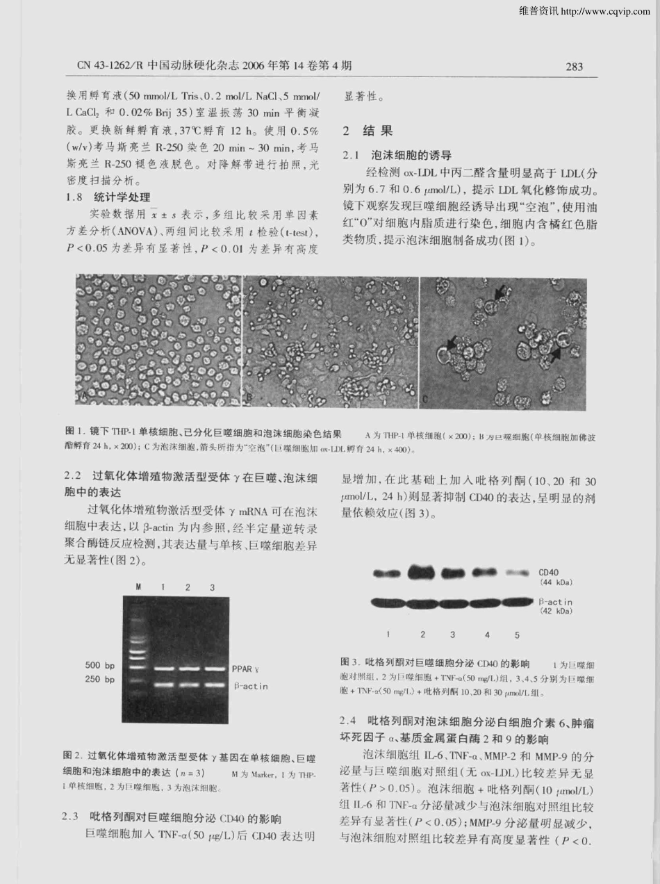 过氧化体增殖物激活型受体配体抑制巨噬一泡沫细胞炎性介质和基质金属蛋白酶2的分泌_第3页