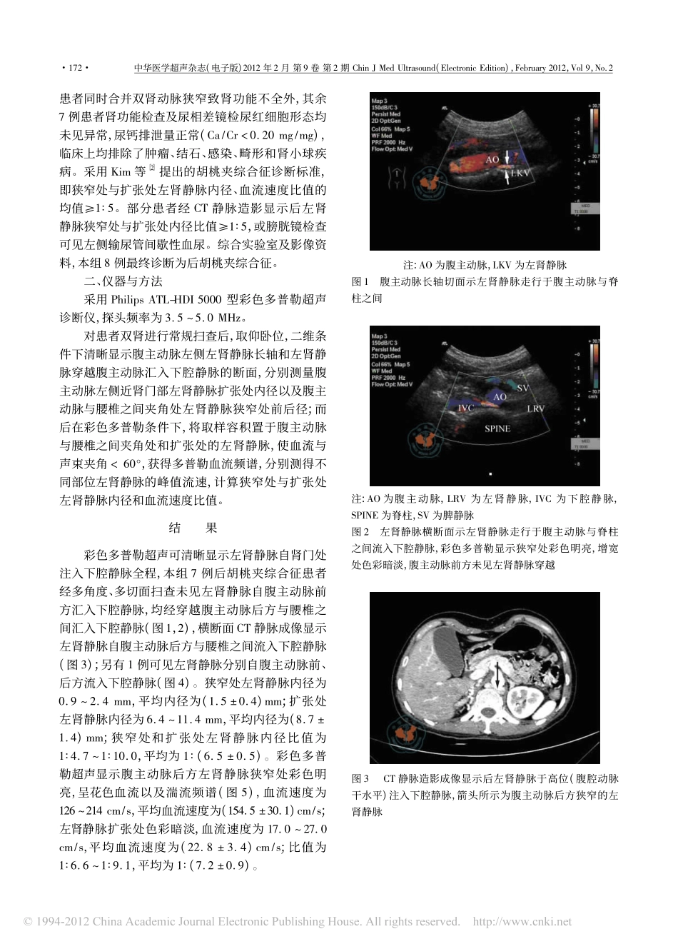 后胡桃夹综合征患者彩色多普勒超声表现_第2页