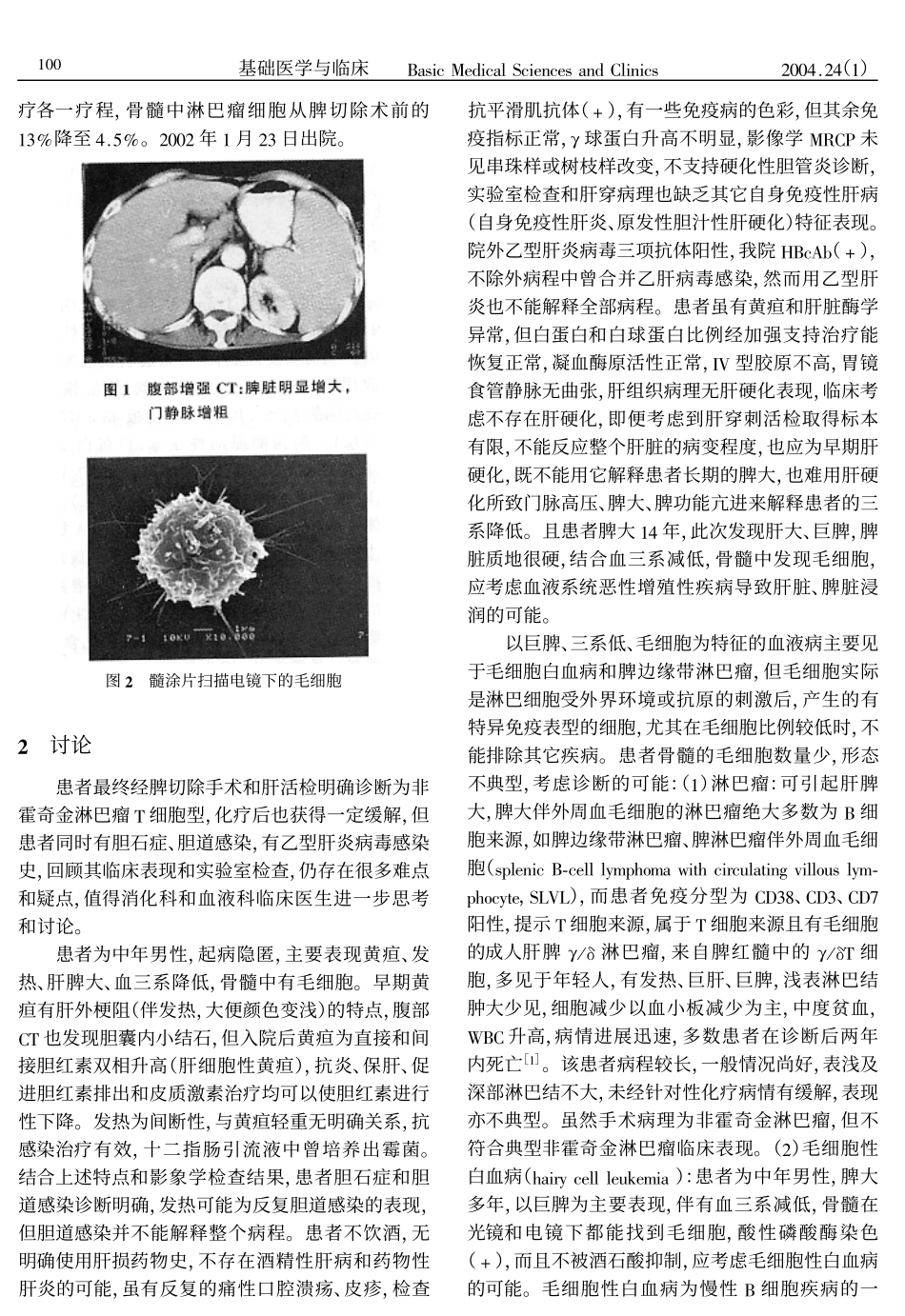 黄疸、发热、肝大、巨脾_第2页