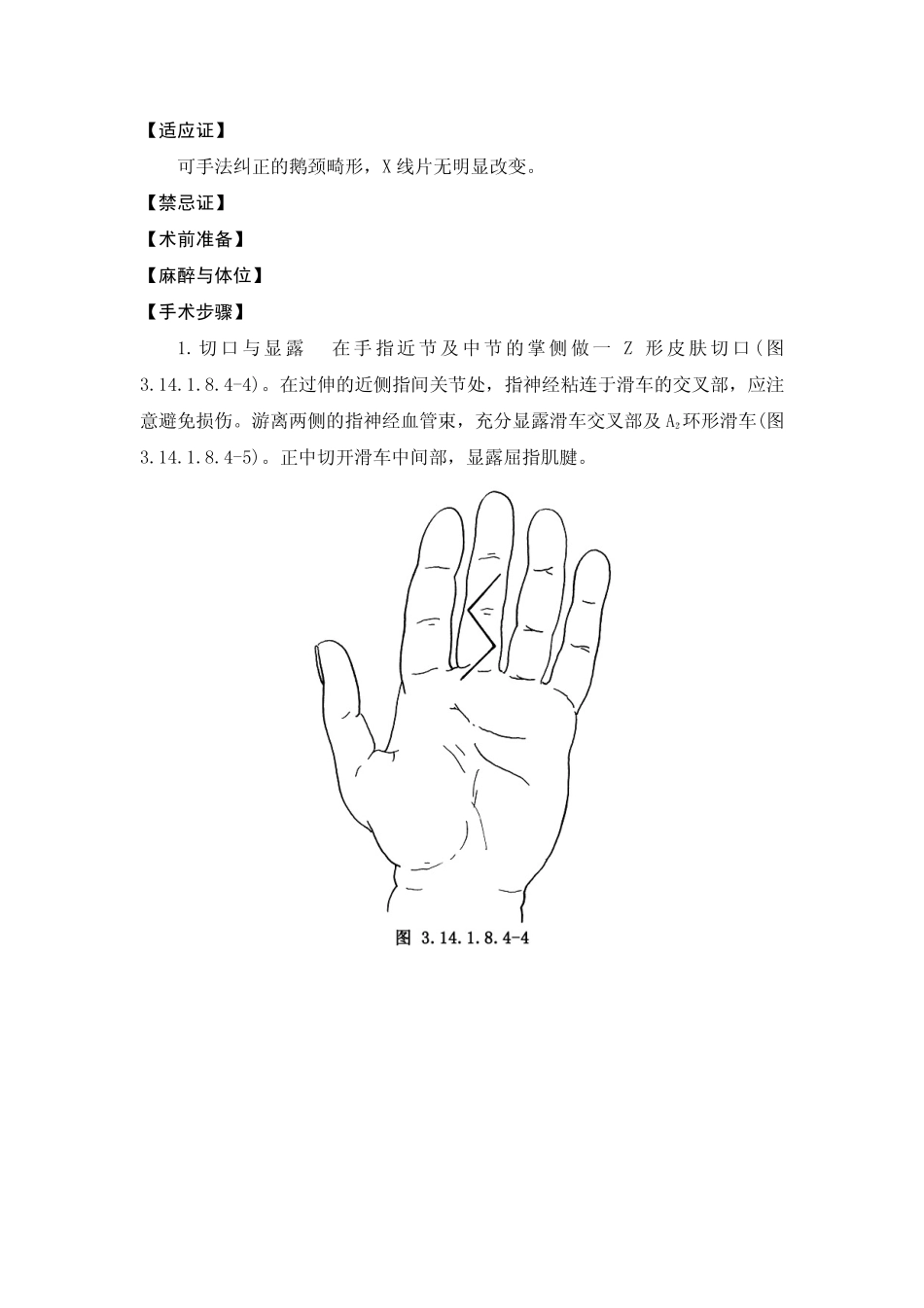 近侧指间关节过伸畸形矫正术_第2页