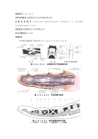 近侧指间关节过伸畸形矫正术