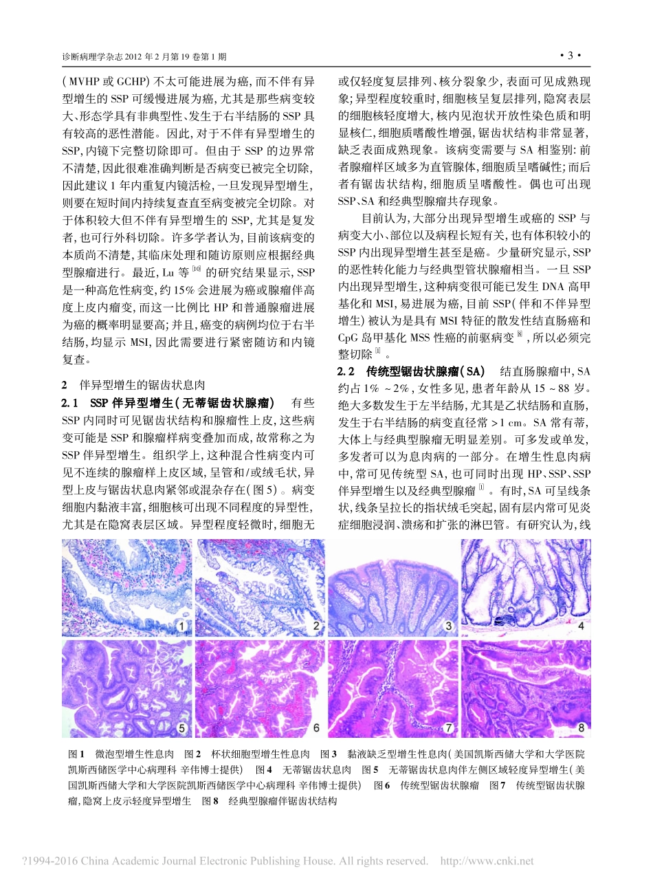 结直肠锯齿状病变_樊祥山_第3页