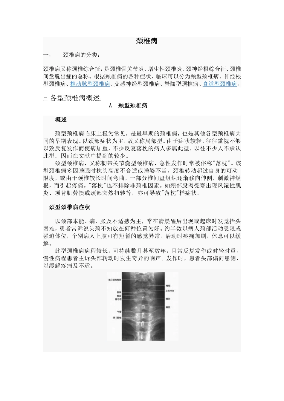 颈椎病 Microsoft Word 文档 (4)_第1页