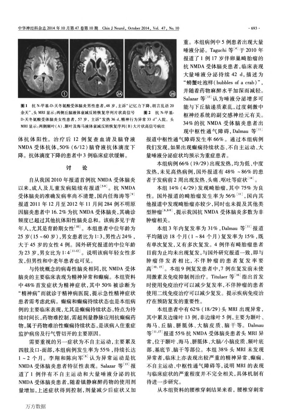 抗N一甲基一D一天冬氨酸受体脑炎_第3页
