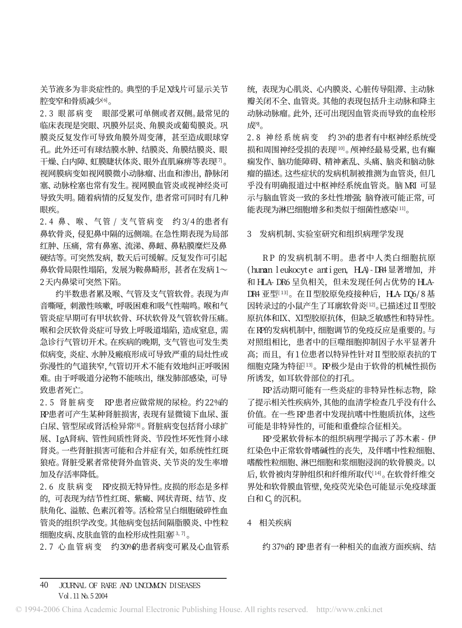 复发性多软骨炎1_第2页