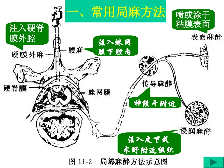 局麻药、抗癫痫、惊厥药_第3页
