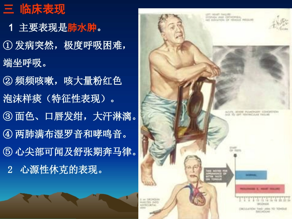 急性左心功能不全ppt_第3页
