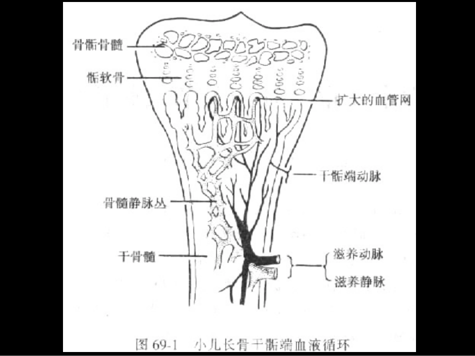 骨与关节化脓性感染 化脓性骨髓炎pyogenic osteomyelitis 概 …_第3页